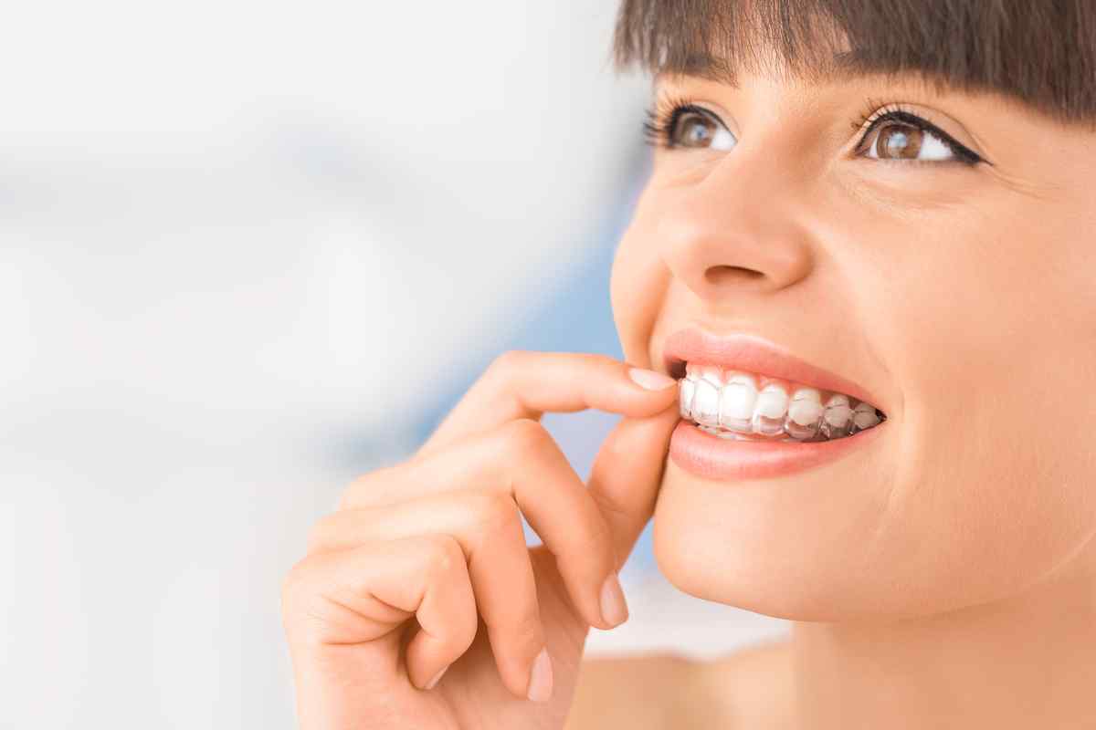 Teeth aligners Dubai